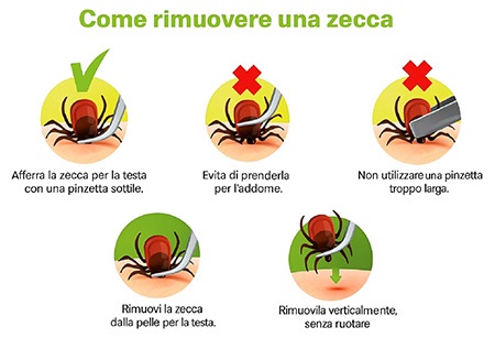 Infografica come rimuovere una zecca